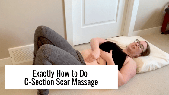 Exactly How to Do C-Section Scar Massage