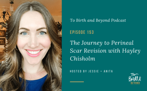 [PODCAST] The Journey to Perineal Scar Revision with Hayley Chisholm